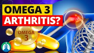 Use Omega-3 Fatty Acids to Heal Bone and Joint Pain ❓ screenshot 5