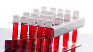 Tajemnicze Badanie Tibc - Kiedy Warto Je Wykonać?