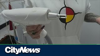 Free gang tattoo removal program in Winnipeg sees expansion screenshot 1