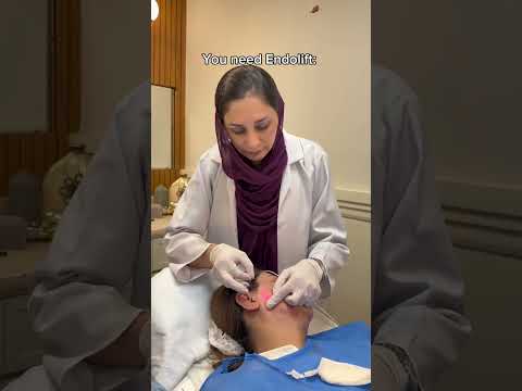 The future of anti aging is here - ENDOLIFT APPOINTMENTS ARE NOW OPEN