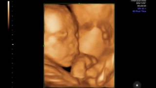 Chin Chin 23 Weeks (4D)