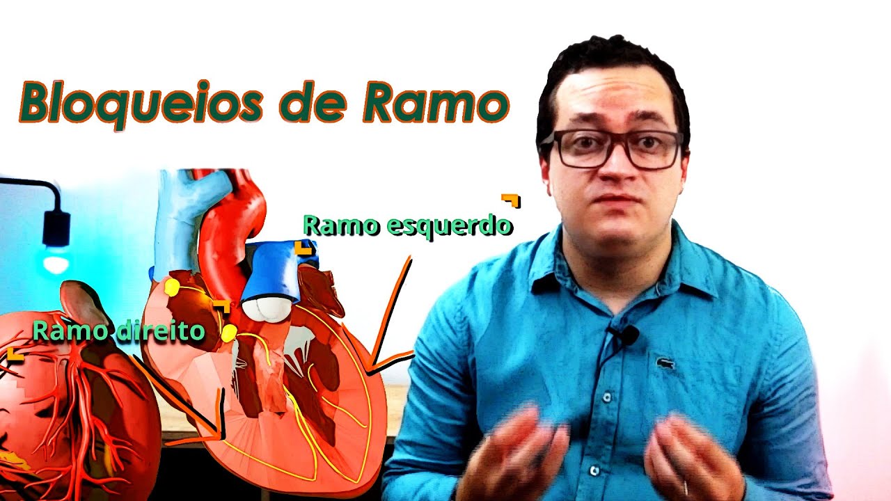 Bloqueios de Ramo (direito e esquerdo)