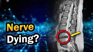 Lumbar Spine MRI: 5 Nerve Warning Signs You Can’t Ignore (2026 Guide)