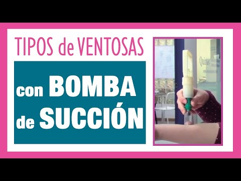 Vídeo: Estándares Para Informar Intervenciones En Ensayos Clínicos De Ventosas (STRICTOC): Extensión De La Declaración CONSORT