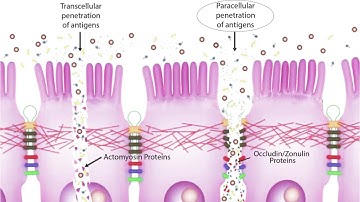 Cyrex Labs - Dr  Chad Larson Explains the Significance of Array 2 Testing