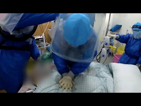 Doctors rescue critically-ill COVID-19 patient in need of intubation