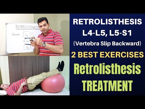 Retrolisthesis- 2 Exercises For Retrolisthesis L4-L5, L5-S1 Treatment- Retrolisthesis Sciatica