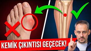 PARMAKTaki ÇIKINTI SONSUZA DEK YOK OLACAK! Ayak kaslarını dengeleyelim