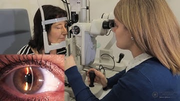 Slit Lamp Techniques   Van Herick