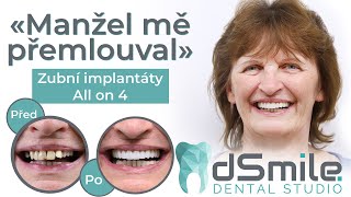 A new smile for 1 visit Dental implants in Prague