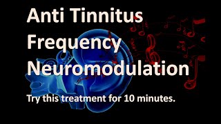 Anti Tinnitus Neuro modulation treatment for all frequencies (Try if it helps you)