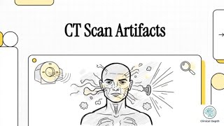 CT Artifacts Explained | Common Types & How They Happen