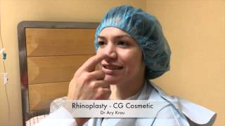 Rhinoplasty Miami Surgery - Part 1