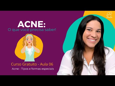 Tipos de Acne [Aula 06 -Acne: Tipos e formas especiais] Curso de Estética Online e Gratuito!