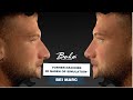 Vorher-Nachher 3D Simulation bei unserem Patienten Marc 👃🏻🖥️*