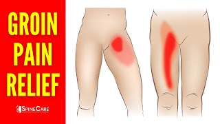 How To Quickly Fix Groin Pain Step - By - Step Guide