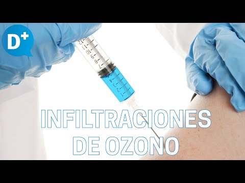 Infiltraciones de ozono para dolores