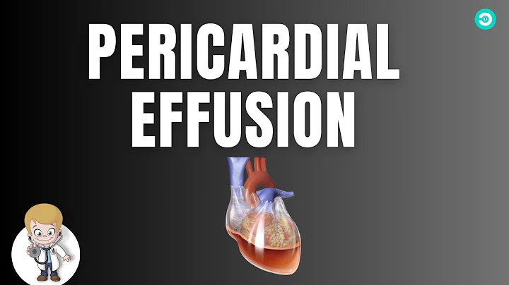 Pericardial Effusion: sign and symptoms, pathophysiology, diagnosis & treatment - DayDayNews