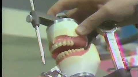 Posterior Teeth - Balanced Occlusion