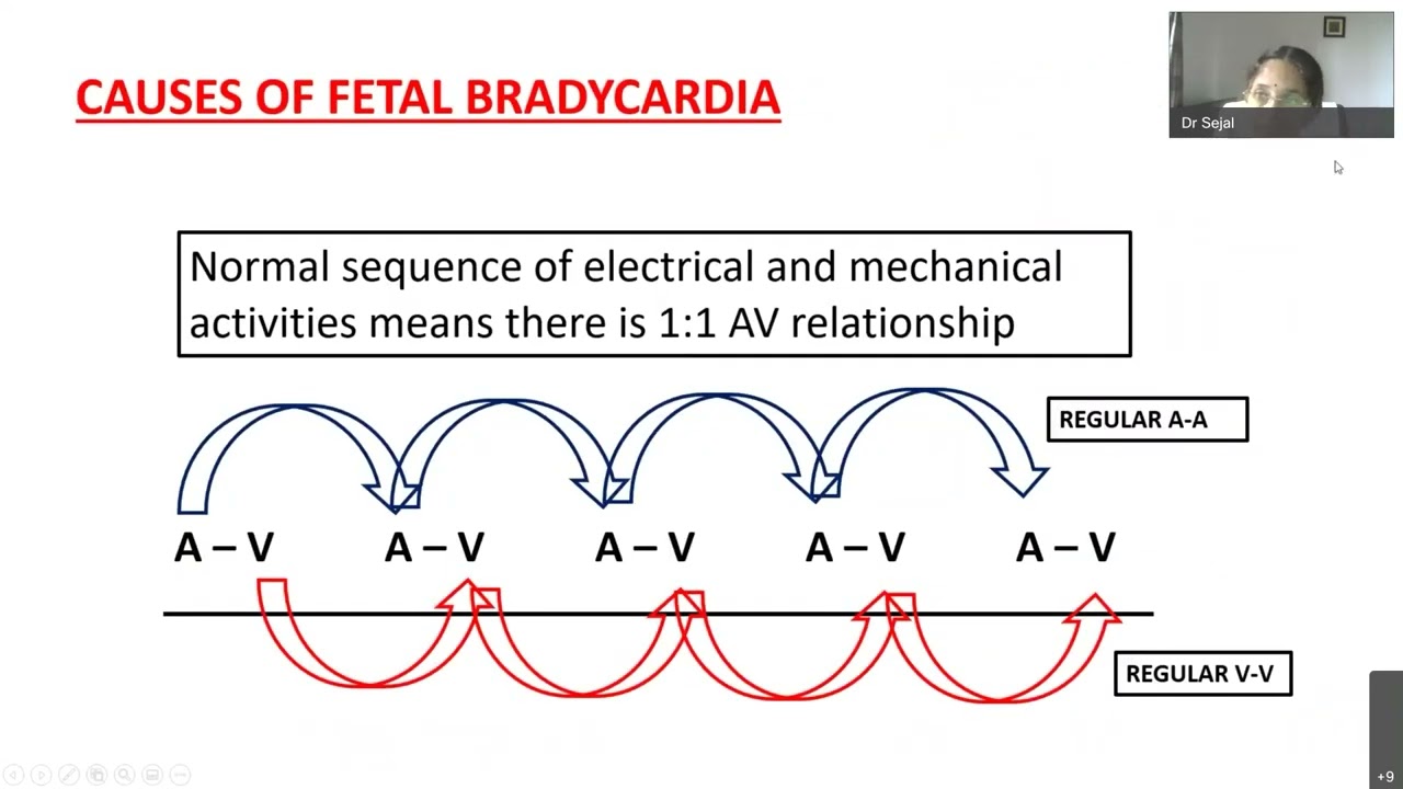 Fetal echo series #4 by Dr Sejal Shah