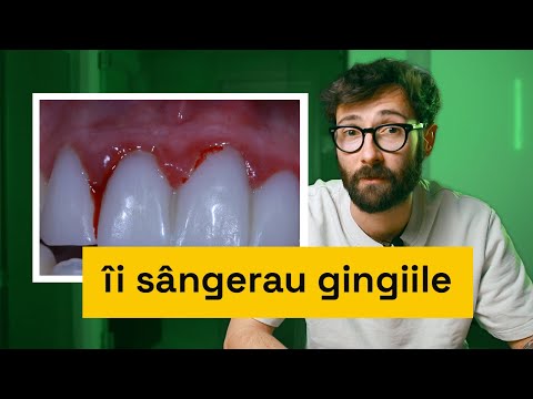 Video: Ce a fost folosit înainte de zirconiu cubic?