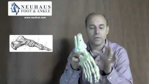 Foot Anatomy: Bones in the Feet
