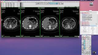 Multiframe SC DICOM part 3