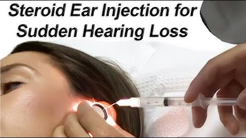 Intra-Tympanic Steroid Injection for Sudden Hearing Loss