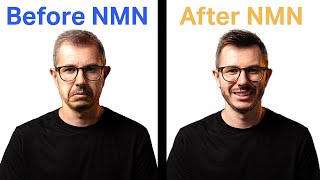 NMN review The Best Anti-Aging Supplement In The World I NMNBio