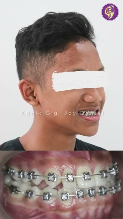 PROSES BEHEL SELAMA 5 BULAN #shorts