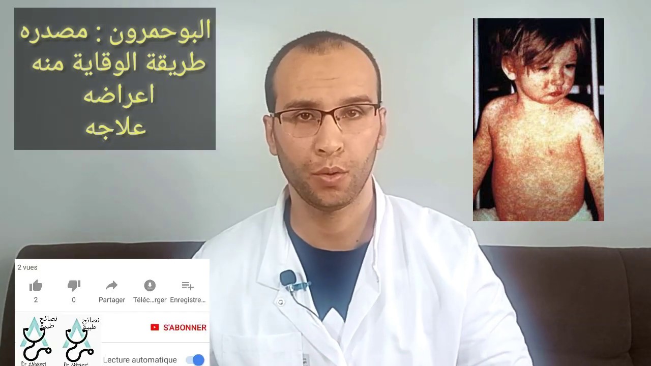 البوحمرون او rougeole  كل شيئ عنه و طريقة علاجه  حافظ على طفلك (بالدارجة المغاربية)