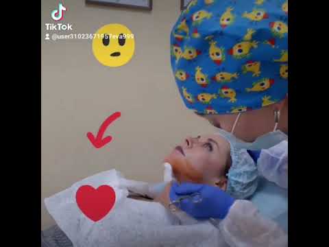 🔥Липоредукция второго подбородка💃 - YouTube