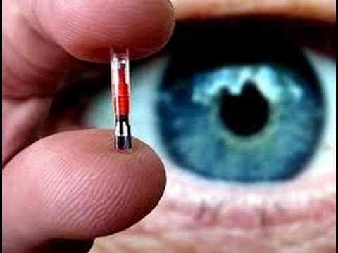 Resultado de imagem para implantação de chip no mao