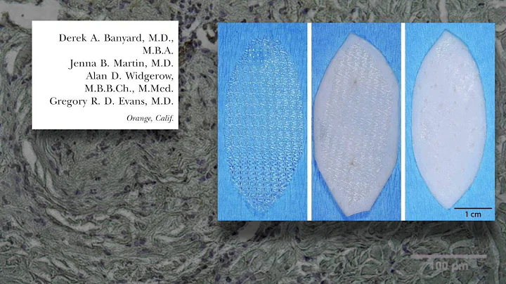 Regenerative Biomaterials- Video Discussion by Geo...