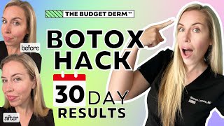 30-Day Botox Hack Results! | $20 Anti-aging Hack | The Budget Dermatologist