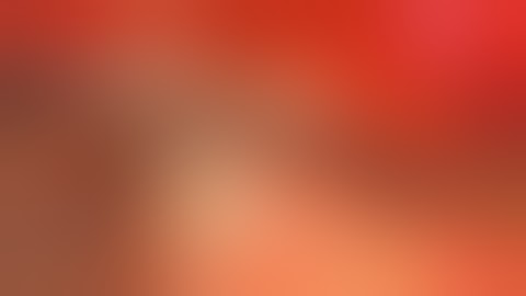 Revision Cochlear Implant with the OmniGuide CO2 Laser Fiber System