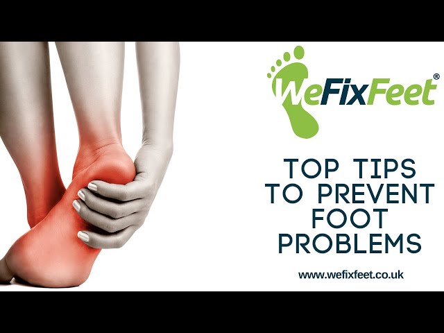 Top Tips To Help Prevent Foot Problems - by We Fix Feet, Nottingham and Derbyshire Foot Health