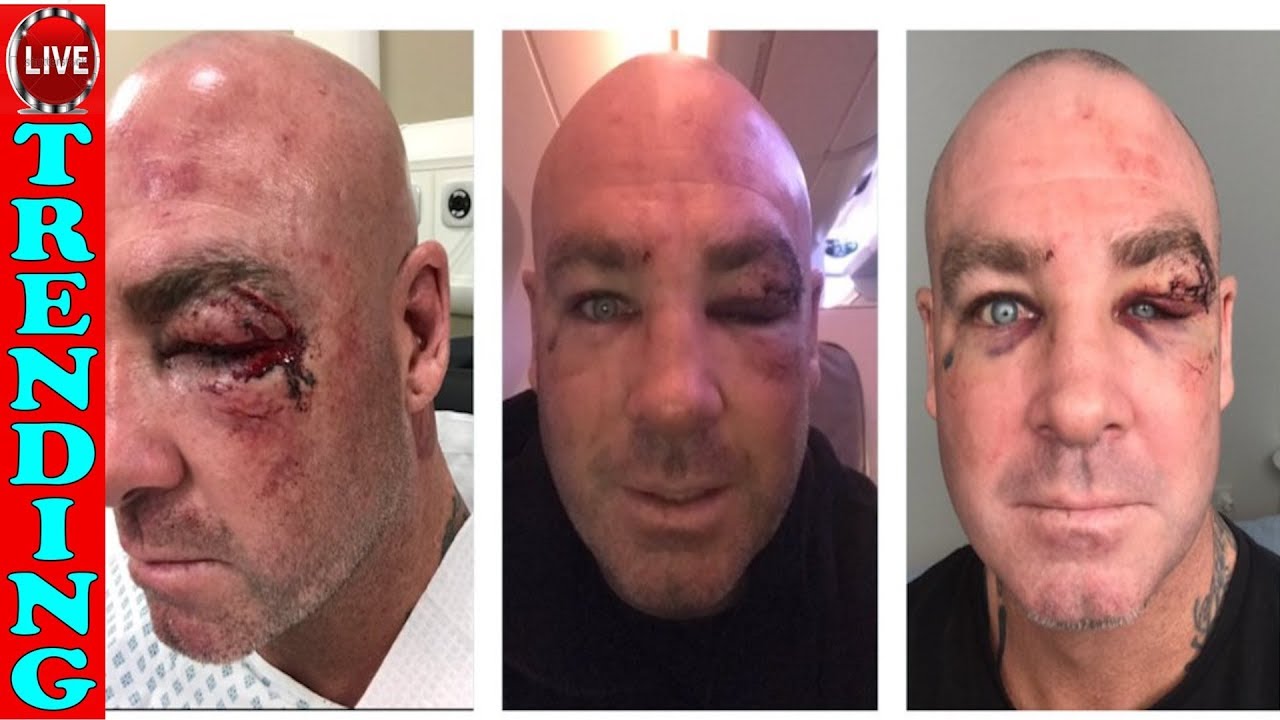 LUCAS BROWNE "FINALLY WOKE!" AFTER DILLIAN WHYTE LOSS