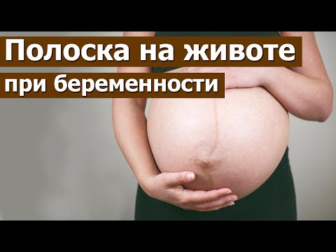 Темная полоска на животе во время беременности