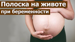 Темная полоска на животе во время беременности