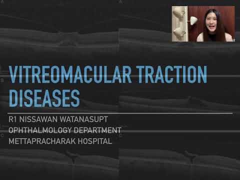 Vitreomacular traction diseases