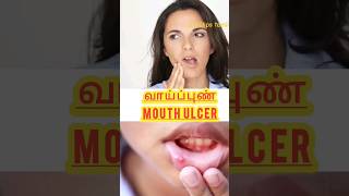 Reason for Mouth ulcer வாய்ப்புண்Canker sore