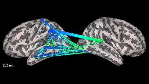GPS: Granger causation displayed as arrows between hemispheres