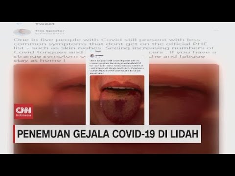 Video: Ujung Lidah Terasa Sakit