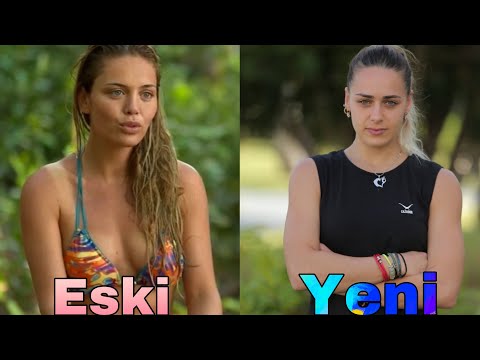 Survivor Kadınlar Artık Neden Bikini Giymiyor?