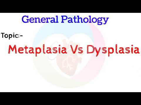 Video: Je metaplazie stejná jako dysplazie?