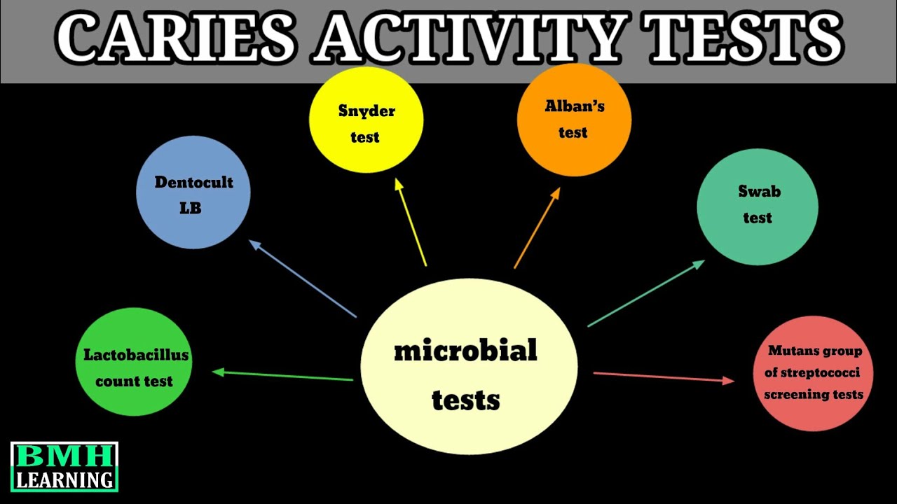caries-activity-tests-youtube