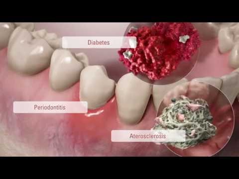 comunicación-entre-células:-salud-bucal-y-enfermedades-sistémicas