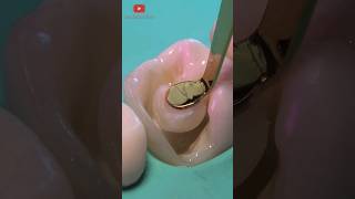 4Kda K Tedavisi Videosu