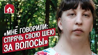 Девушка с синдромом Шерешевского-Тернера: Вика | Быть молодым